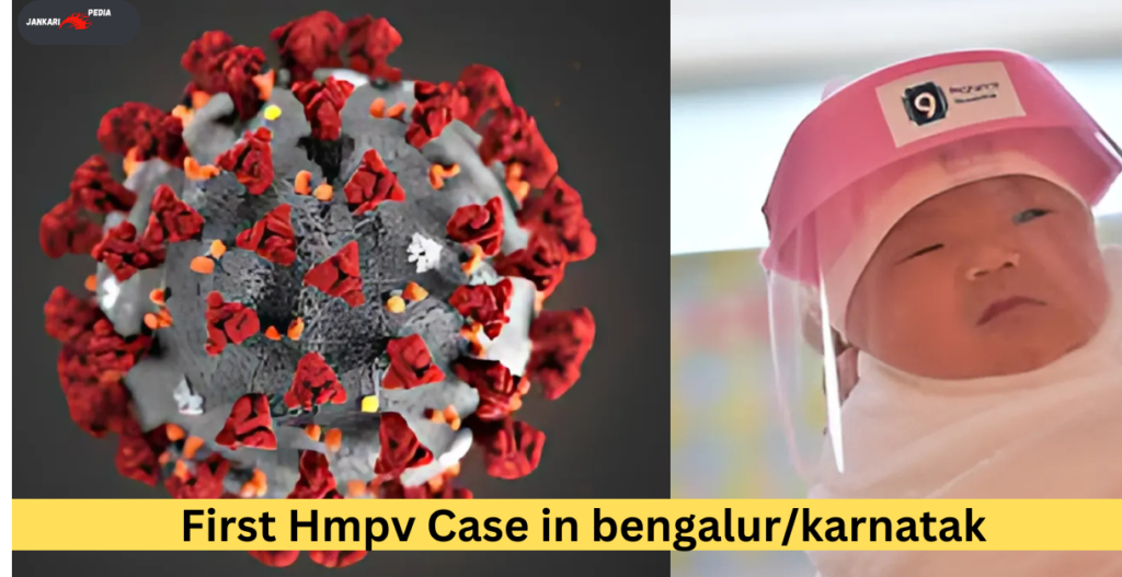 First Hmpv Case in bengalur/karnatak